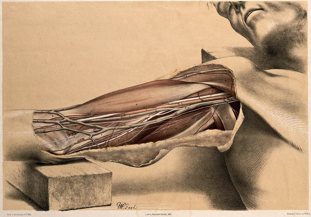 Dissection of the upper arm showing muscles, blood vessels, and nerves, coloured lithograph.